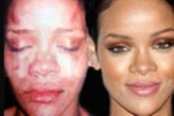 Rihanna Sevgilisinden Dayak Yedi Son Dakika Magazin