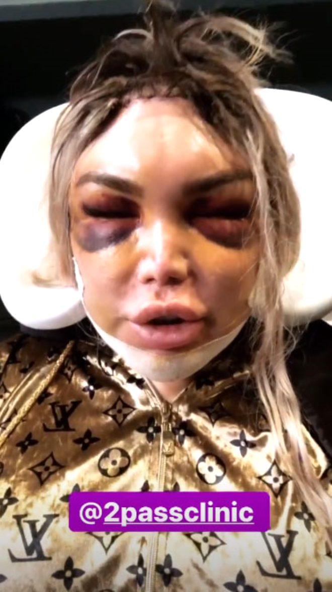 Defalarca Bicak Altina Yatan Ken Bebek Yuzundeki Morluklarla Gorenleri Korkuttu Son Dakika Dunya