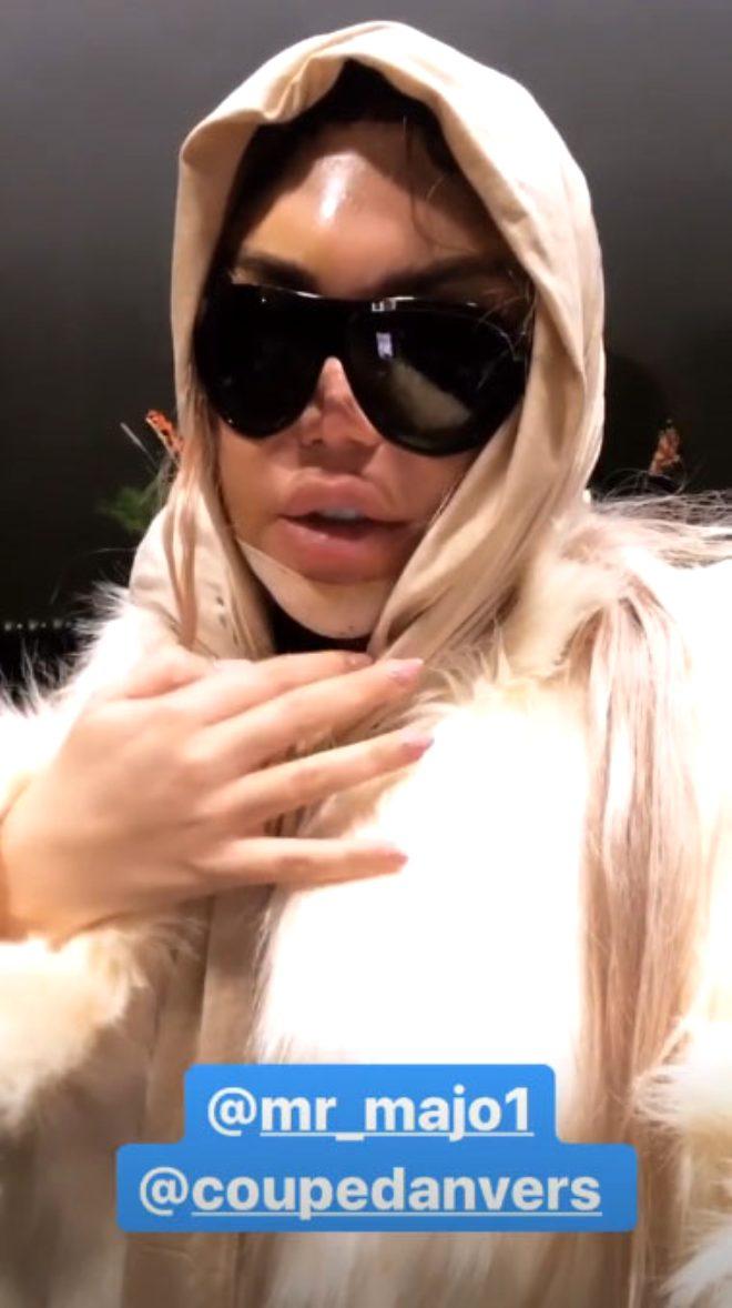 Defalarca Bicak Altina Yatan Ken Bebek Yuzundeki Morluklarla Gorenleri Korkuttu Son Dakika Dunya