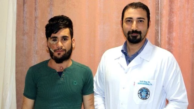 Yüzü Parçalanan Gencin Aynalarla Küslüğü Edirne'de Son Buldu
