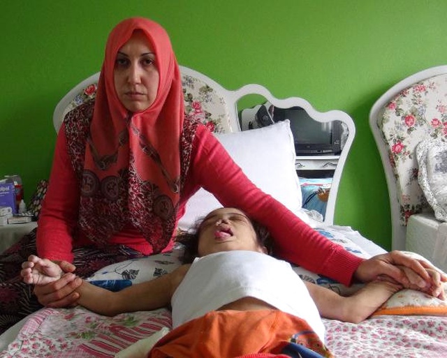 Acıyı Hissetmediği İçin Dişlerini Söken ve Burnunu Parçalayan <a class='keyword-sd' href='/bebek/' title='Bebek'>Bebek</a> Öldü