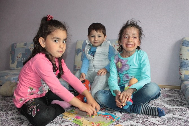 6 Yaşındaki Azra'nın Derisi, Balık Pulu Gibi Dökülüyor