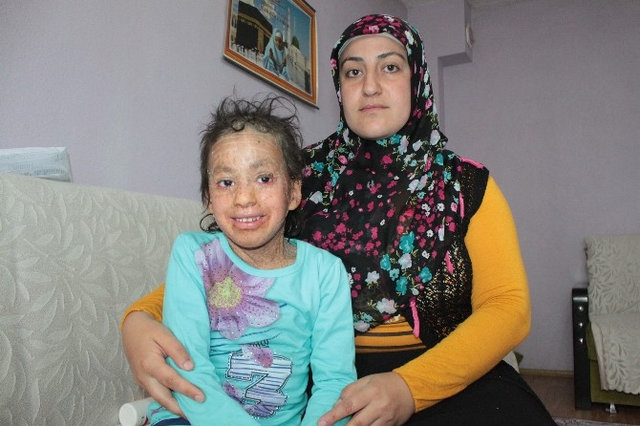 6 Yaşındaki Azra'nın Derisi, Balık Pulu Gibi Dökülüyor