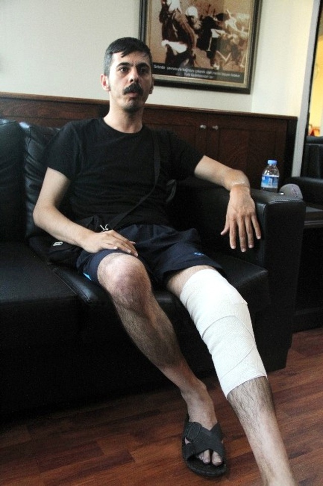 Bombalı Saldırıda Yaralanan Taksici Cehennemi Anlattı: Görmek İstemezdiniz