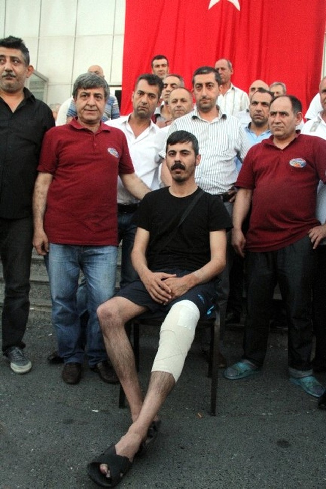 Bombalı Saldırıda Yaralanan Taksici Cehennemi Anlattı: Görmek İstemezdiniz