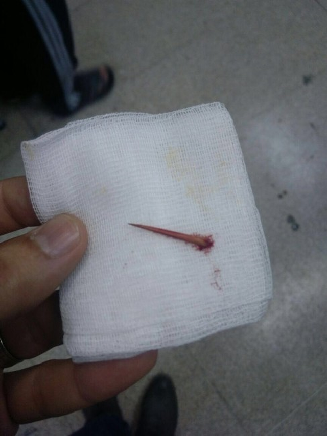 Batan Diken Nedeniyle Az Kalsın Kolunu Kaybediyordu