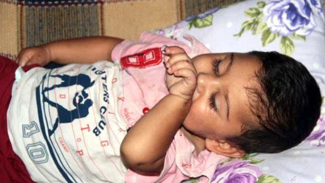 Isırarak Kendine Zarar Veren Bebeğin Ailesi Yardım İstedi