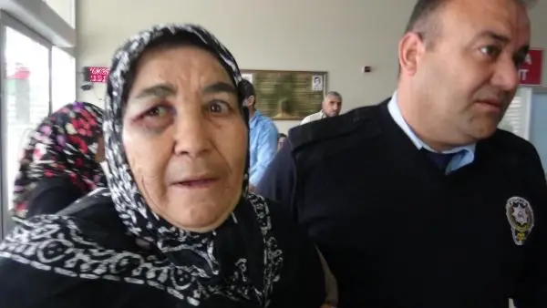 Eşinden 55 Yıldır Dayak Yiyen Kadın Polise Sığındı