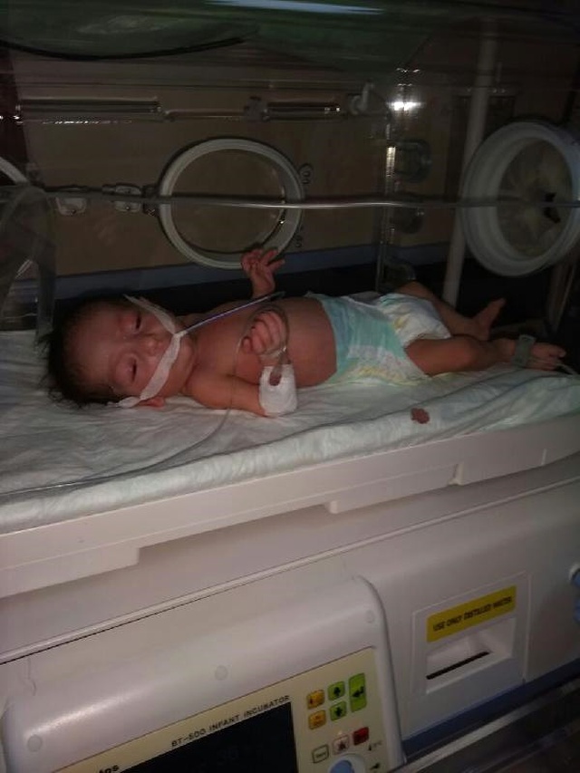 Ambulans Verilmeyen Kalbi Delik Bebek Yaşamını Yitirdi