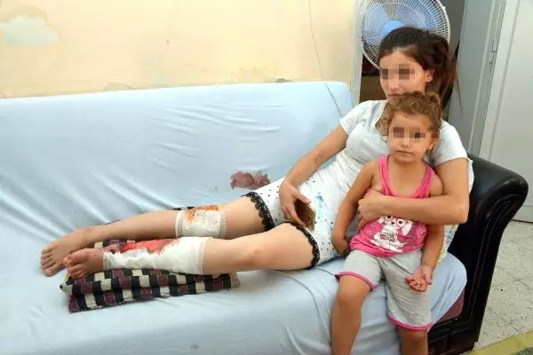 Eski Eşinin Silahlı Saldırısına Uğrayan Kadının Çığlığı Duyuldu, Savcılık Koruma Verdi