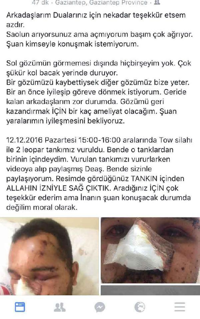 El Bab'da Yaralanan Uzman Onbaşı: Bir Gözü Kaybettiysek Diğeri Bize Yeter