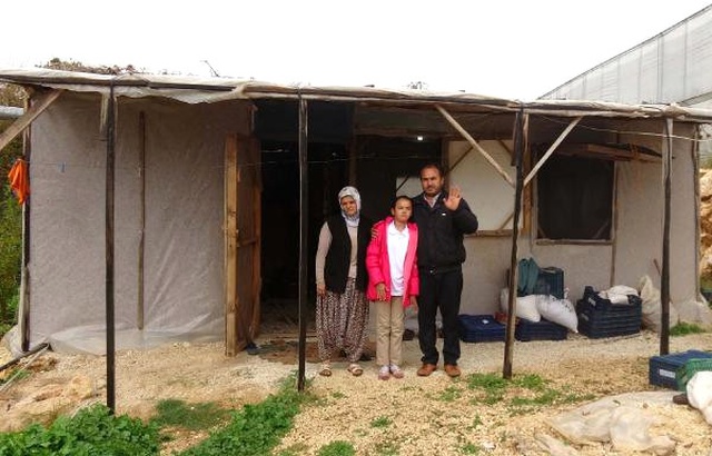 Rümeysa'nın Ameliyatı İçin 150 Bin Lira Gerekiyor