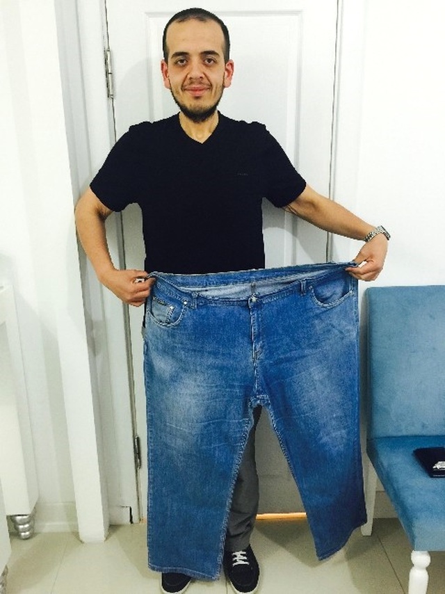 Kiloları MR Cihazına Fazla Geldi, Azimle 1 Senede 84 Kilo Verdi