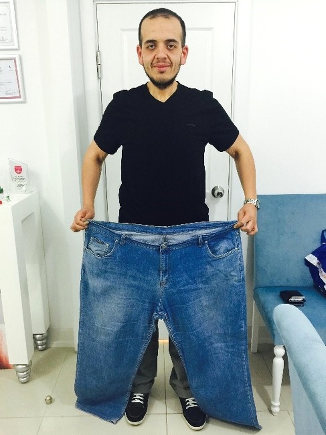 Kiloları MR Cihazına Fazla Geldi, Azimle 1 Senede 84 Kilo Verdi