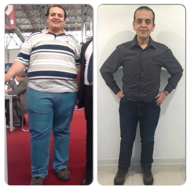 Kiloları MR Cihazına Fazla Geldi, Azimle 1 Senede 84 Kilo Verdi