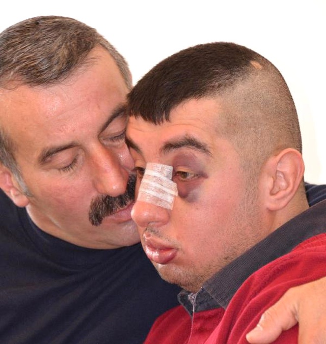 Zihinsel Engelli Genci, Sokakta Kolundan Tuttuğu Kızın Ailesi Tekme <a class='keyword-sd' href='/tokat/' title='Tokat'>Tokat</a> Dövdü