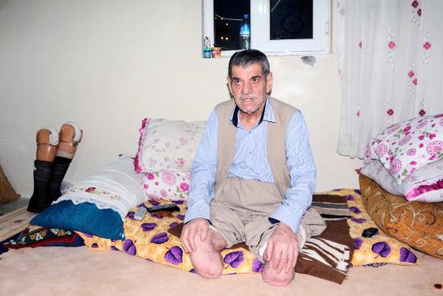 Sigara Yüzünden 2 Bacağını Kaybeden Ahmet Şan'dan Uyarı