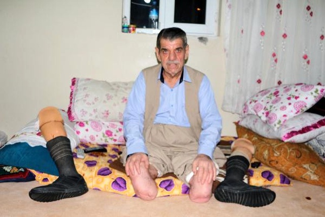 Sigara Yüzünden 2 Bacağını Kaybeden Ahmet Şan'dan Uyarı