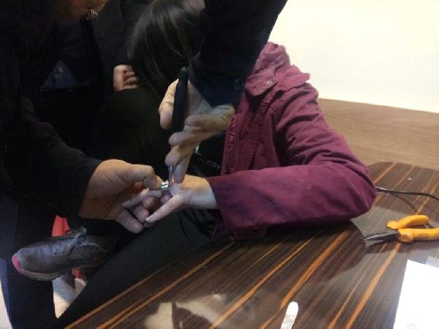 Çocuğun Parmağına Sıkışan Yüzük Kesilerek Çıkarıldı