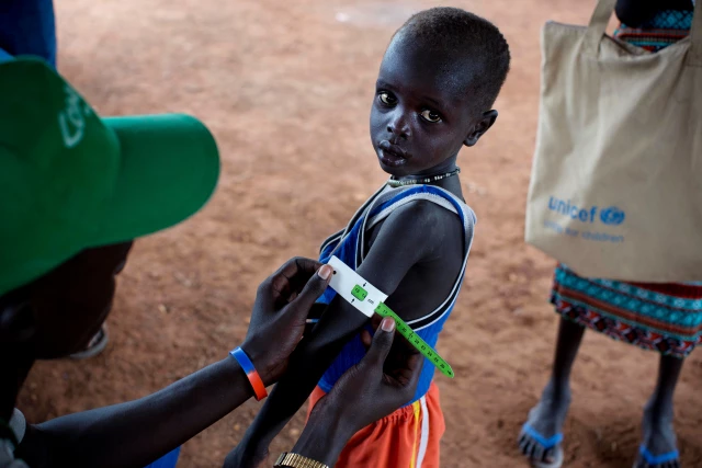 UNICEF: 1,4 Milyon Çocuk Açlıktan Ölebilir
