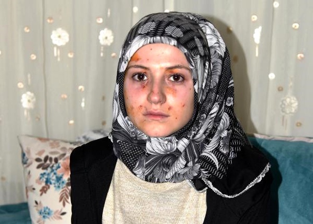 Kız Öğrencilerin Kavgası Karakolda Bitti