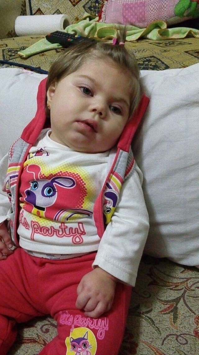 Görme, Konuşma ve Yürüme Yetisini Kaybeden Berre Bebek Yardım Bekliyor