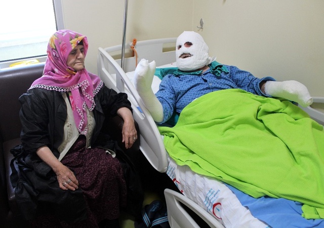İşçilere Yemek Isıtan Aşçı, Odada Biriken Gazın Patlamasıyla Yanıklar İçinde Kaldı
