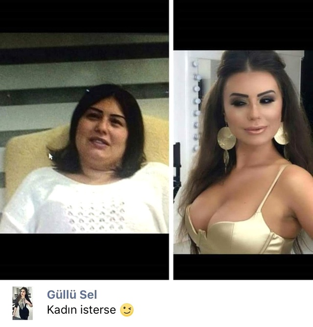 İki Çocuk Annesi Adanalı
