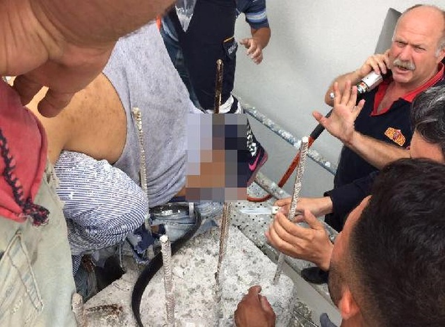 Boyacı Genç İskeleden Düştü, Kalçasından Giren Demir Sırtından Çıktı!