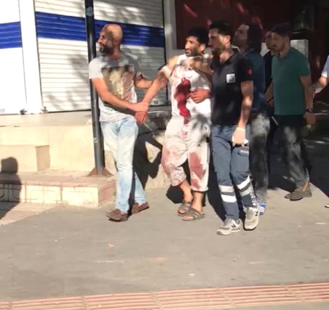 Eşini ve Kızını Yaralayan Baba 1.5 Saat Sonra Polise Teslim Oldu