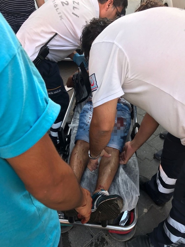Boşanmak Üzere Olduğu Karısını Başka Erkekle Gören Koca, Dehşet Saçtı