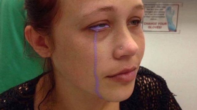 Gözünün Akına Dövme Yaptırmaya Gitti, Kısmen Kör Olarak Çıktı