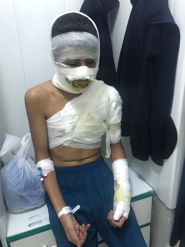Lise Öğrencisi Okulda Alevler İçinde Kaldı! O Anlar Kameraya Yansıdı