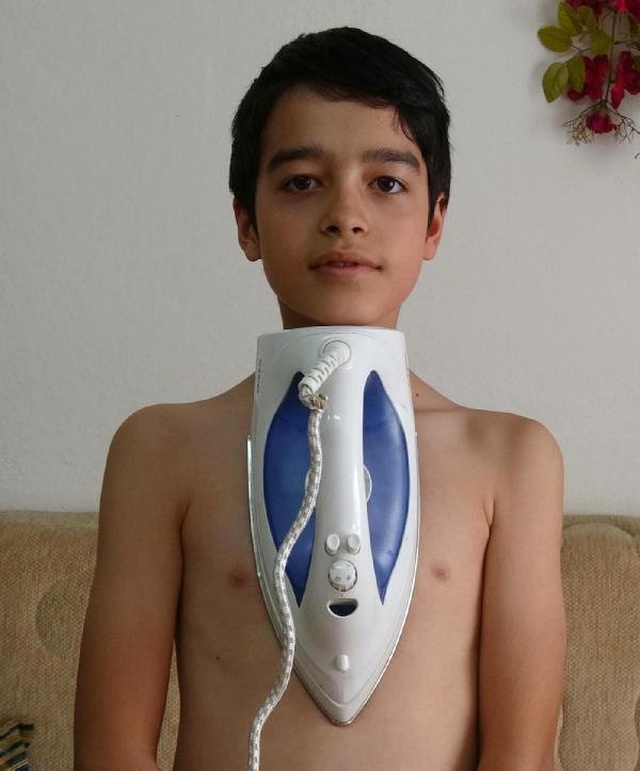 Mıknatıs Çocuk Şaşırtıyor! Kaşıktan Ütüye Her Şeyi Vücudunda Tutabiliyor