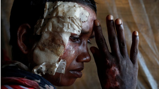 Sınır Tanımayan Doktorlar: Myanmar'da Bir Ay İçinde Binlerce Arakanlı Müslüman Öldürüldü