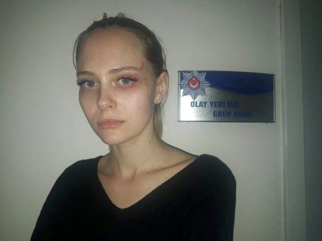 Türkiye'de Çalışan Ukraynalı Manken: Ajans Patronu Bana Tecavüz Etti