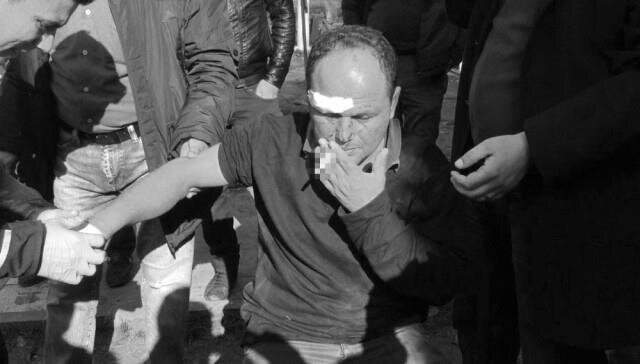 İhalede Tehdit Edilen Nakliyeci, Feci Şekilde Dövüldü