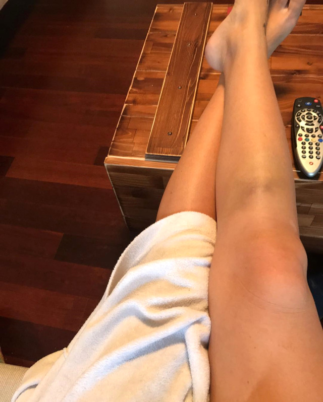 Seda Akgül, Takipçilerinin Eleştirilerine Cevap İçin Bacağının Fotoğrafını Paylaştı