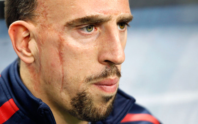 Ünlü Futbolcu Ribery: Beni Görenler 