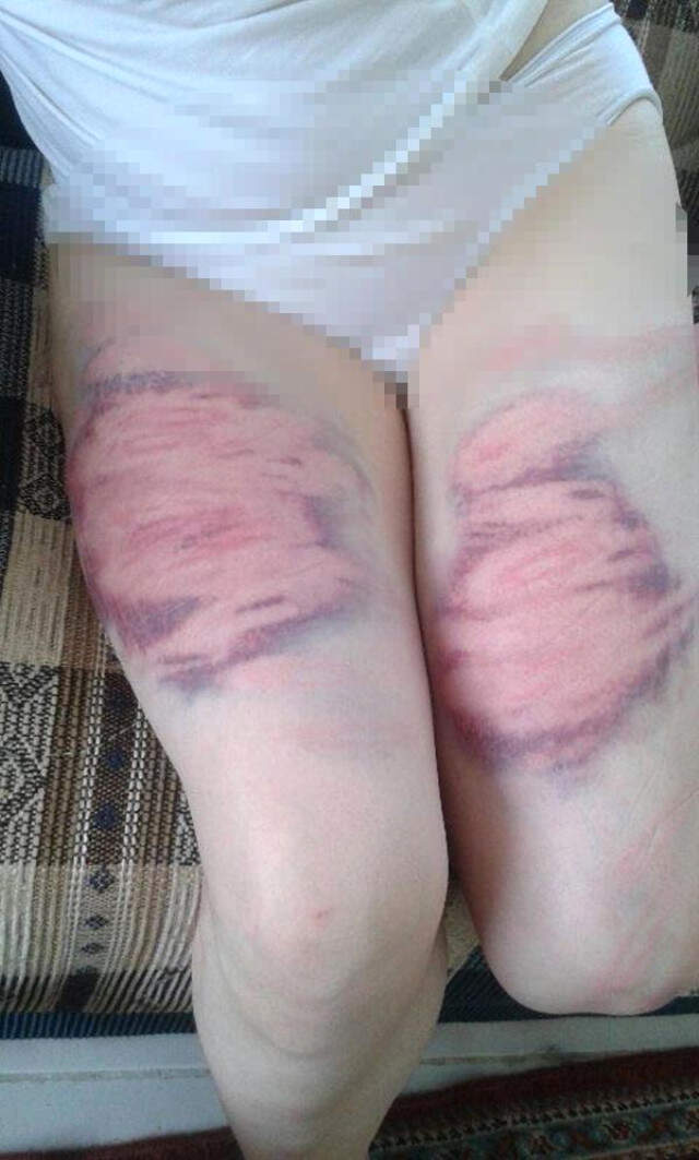 Eşini Oklavayla Döven Kocadan Pişkin Savunma: 4-5 Kez Vurmuş Olabilirim Ama Darp Etmedim