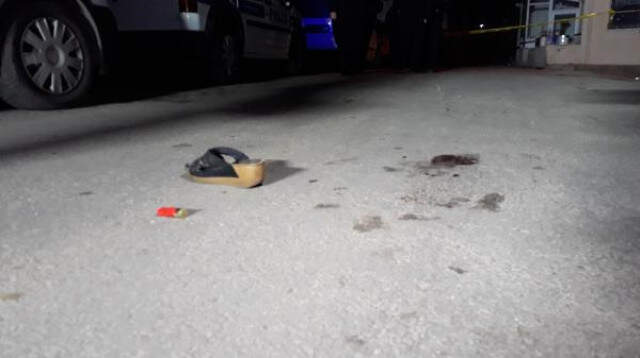 Kavga Edenleri Duyunca Sokağa Çıktı, Göğsünden Vuruldu