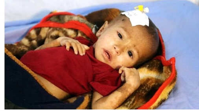 Yemen Başbakanı: Aden'de Hükümet Binalarını Ele Geçiren Ayrılıkçılar Darbe Peşinde