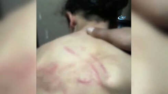 Zabıtaları Suçlayan Suriyeli Çocuğun, Babasından İşkence Gördüğü Ortaya Çıktı