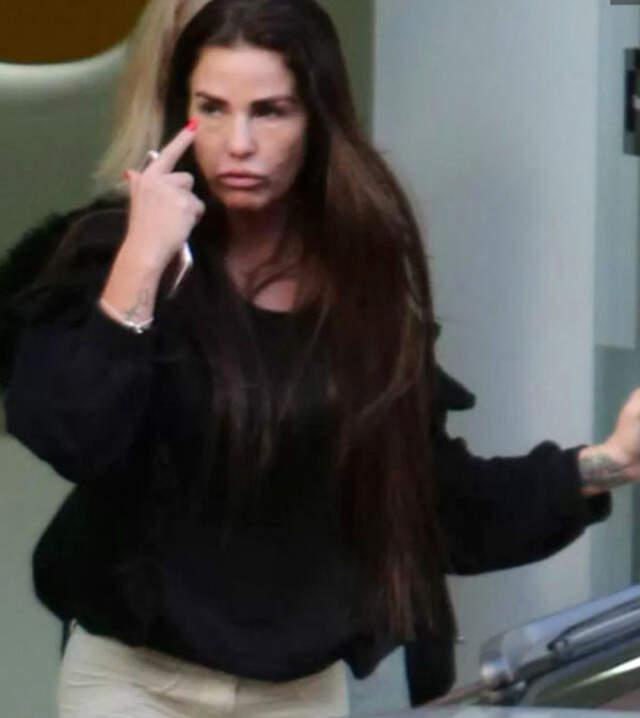 Bir Dönemin Gözde İsmi Katie Price, Estetik Cerrahının Kurbanı Oldu