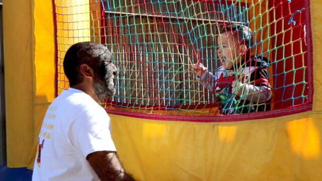 Suratının Yüzde 98'i Kıllarla Kaplı! Dünyanın En Kıllı İnsanı Artık Çok Mutlu