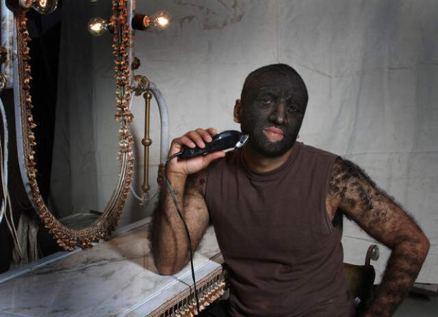 Suratının Yüzde 98'i Kıllarla Kaplı! Dünyanın En Kıllı İnsanı Artık Çok Mutlu