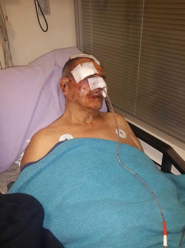 İzmir'de Komşusundan 1,5 Yıllık Aidatı İsteyen Yaşlı Adam, Hastanelik Oldu
