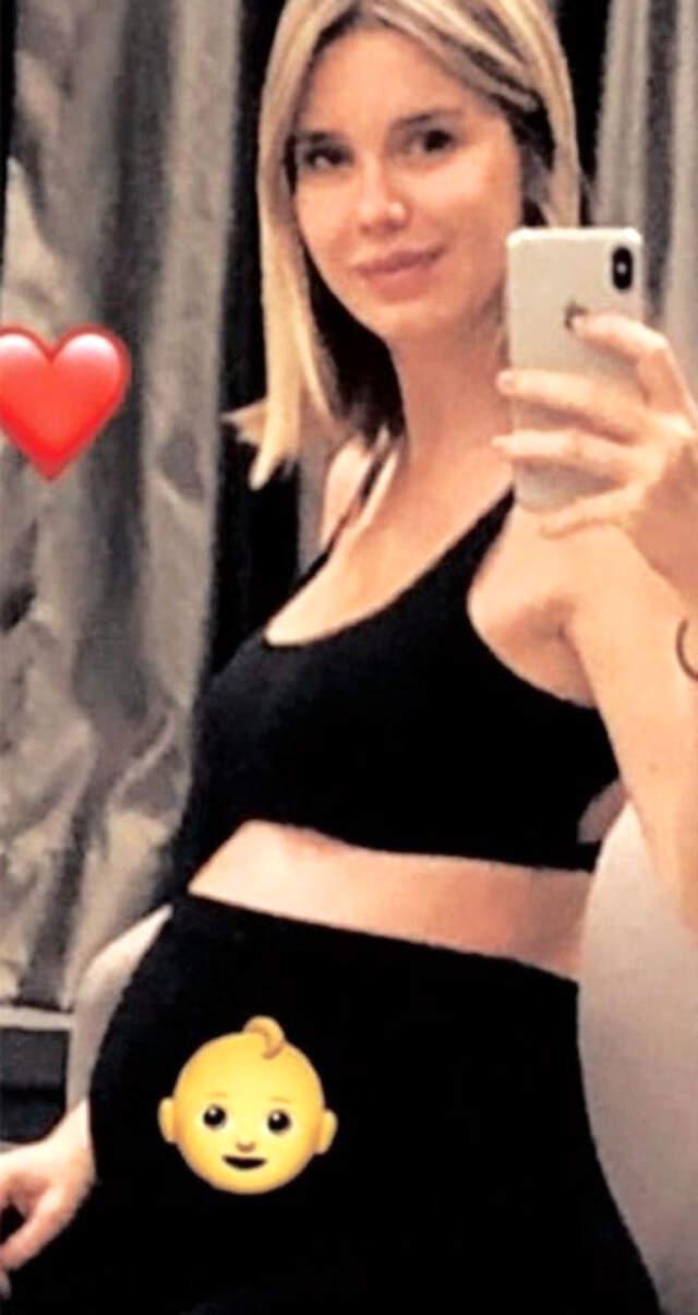 Ali Ağaoğlu'nun Oğlu, Sevgilisinin Doğurmasına 1,5 Ay Kala Evlendi