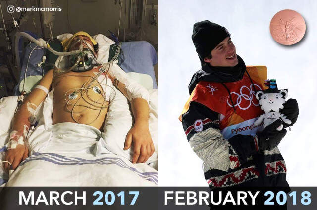 Ölümden Dönen Kanadalı Sporcu, Olimpiyat Madalyası Kazandı