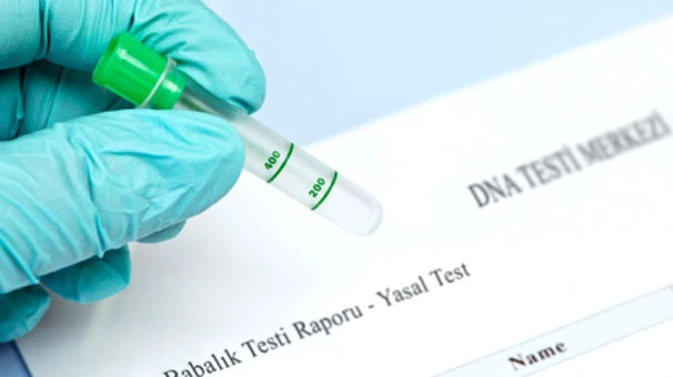 DNA Testi Yaptıranlarda Rekor Artış! Günde 100 Kişi Babalık Testi İçin Başvuruyor